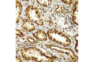 Immunohistochemistry of paraffin-embedded human kidney using SMAD9 antibody (ABIN5975592) at dilution of 1/100 (40x lens). (SMAD9 anticorps)