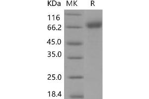 Western Blotting (WB) image for Interleukin 1 Receptor, Type I (IL1R1) (Active) protein (Fc Tag) (ABIN7320140) (IL1R1 Protein (Fc Tag))