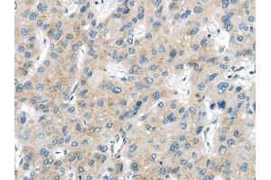 Immunohistochemistry (IHC) image for anti-Vacuolar Protein Sorting-Associated Protein 26A (VPS26A) antibody (ABIN5959956) (VPS26A anticorps)