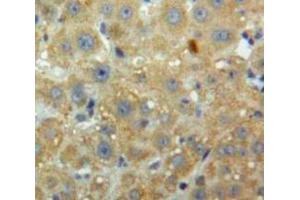IHC-P analysis of Liver tissue, with DAB staining. (PCSK9 anticorps  (AA 156-461))
