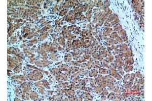 Immunohistochemistry (IHC) analysis of paraffin-embedded Human Pancreas, antibody was diluted at 1:100. (CXCR6 anticorps  (N-Term))