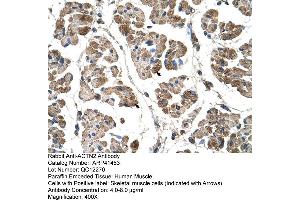 Rabbit Anti-ACTN2 Antibody  Paraffin Embedded Tissue: Human Muscle Cellular Data: Skeletal muscle cells Antibody Concentration: 4.