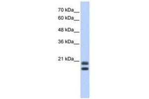 Image no. 1 for anti-serglycin (SRGN) (AA 71-120) antibody (ABIN6742973) (SRGN anticorps  (AA 71-120))