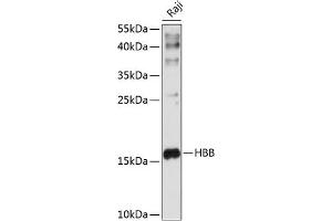 Western blot analysis of extracts of Raji cells, using HBB antibody (ABIN6133523, ABIN6141639, ABIN6141641 and ABIN6217257) at 1:1000 dilution. (Hemoglobin Subunit beta anticorps  (AA 1-147))