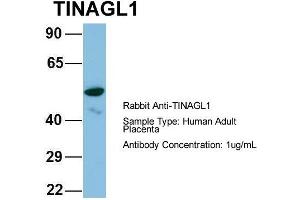 Host: Rabbit Target Name: CHAD Sample Type: Human Adult Placenta Antibody Dilution: 1. (TINAGL1 anticorps  (Middle Region))