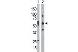 PRKR antibody used in western blot to detect PRKR/PKR in mouse uterus tissue lysate (Lane 1) and HepG2 cell lysate (2).