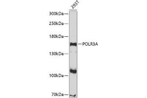 anti-Polymerase (RNA) III (DNA Directed) Polypeptide A, 155kDa (POLR3A) (AA 1-200) antibody