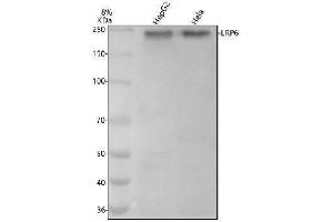 Western blot analysis of LRP6 using anti-LRP6 antibody (ABIN7605450).