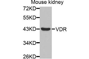 Western blot analysis of extracts of mouse kidney cells, using VDR antibody.