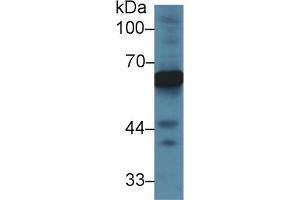 Detection of AFP in Rat Cerebrum lysate using Polyclonal Antibody to Alpha-Fetoprotein (AFP)