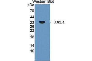 Western blot analysis of the recombinant protein. (APBA2 anticorps  (AA 459-722))