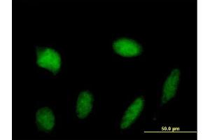 Immunofluorescence of purified MaxPab antibody to STAT5A on HeLa cell.