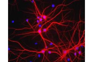 Immunofluorescence - MAP2 Antibody. (MAP2 anticorps)