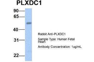 Host:  Rabbit  Target Name:  PLXDC1  Sample Type:  Human Fetal Heart  Antibody Dilution:  1. (PLXDC1 anticorps  (N-Term))