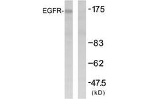 Western blot analysis of extracts from HuvEc cells, using EGFR (Ab-1092) Antibody. (EGFR anticorps  (AA 1061-1110))