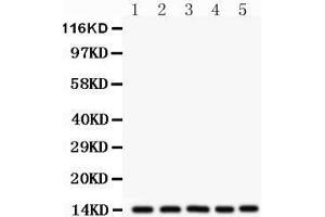 Western Blotting (WB) image for anti-Fatty Acid Binding Protein 1, Liver (FABP1) (AA 6-36), (N-Term) antibody (ABIN3042384)