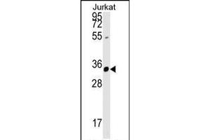 ZFYVE27 Antibody (N-term) (ABIN1539257 and ABIN2848777) western blot analysis in Jurkat cell line lysates (35 μg/lane). (ZFYVE27 anticorps  (N-Term))