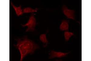 ABIN6267520 staining Hela by IF/ICC.