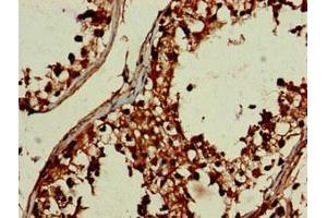 Immunohistochemistry of paraffin-embedded human testis tissue using ABIN7149738 at dilution of 1:100 (DEPDC1B anticorps  (AA 343-529))