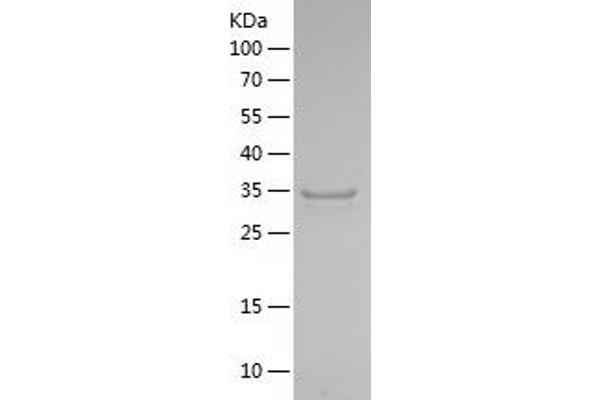 Serotonin Receptor 4 Protein (HTR4) (AA 210-264) (His-IF2DI Tag)