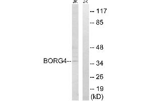 Western blot analysis of extracts from Jurkat cells, using BORG4 antibody.