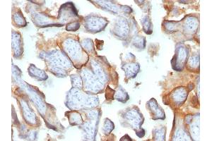 Formalin-fixed, paraffin-embedded human Placenta stained with hCG beta Monoclonal Antibody (SPM105). (CGB anticorps)