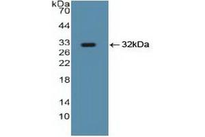 Detection of Recombinant Smad5, Human using Polyclonal Antibody to SMAD family member 5 (SMAD5) (SMAD5 anticorps  (AA 210-464))