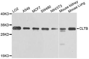 Western blot analysis of extracts of various cell lines, using CLTB antibody. (CLTB anticorps  (AA 1-211))