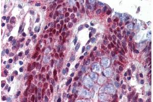 Human Colon: Formalin-Fixed, Paraffin-Embedded (FFPE)