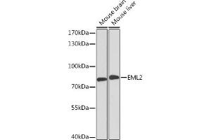 Western blot analysis of extracts of various cell lines, using EML2 Rabbit pAb (ABIN6127842, ABIN6140161, ABIN6140163 and ABIN6218510) at 1:3000 dilution. (EML2 anticorps  (AA 150-415))