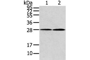 Western Blotting (WB) image for anti-Potassium Large Conductance Calcium-Activated Channel, Subfamily M, beta Member 1 (KCNMB1) antibody (ABIN5958468)