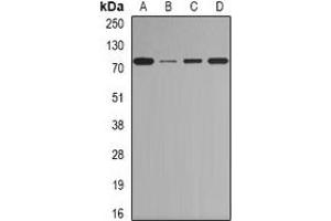 Western blot analysis of BORIS expression in Jurkat (A), Hela (B), mouse heart (C), rat testis (D) whole cell lysates.