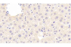 Detection of RBP4 in Mouse Liver Tissue using Polyclonal Antibody to Retinol Binding Protein 4 (RBP4)