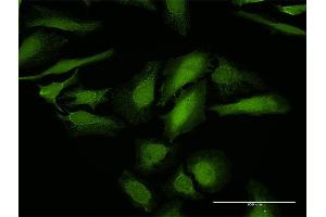 Immunofluorescence of purified MaxPab antibody to LGALS1 on HeLa cell. (LGALS1/Galectin 1 anticorps  (AA 1-135))