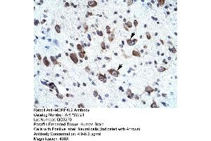 Rabbit Anti-MORF4L2 Antibody       Paraffin Embedded Tissue:  Human neural cell   Cellular Data:  Epithelial cells of renal tubule  Antibody Concentration:   4. (MORF4L2 anticorps  (N-Term))