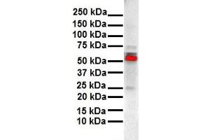 WB Suggested Anti-ESR2 antibody Titration: 1 ug/mL Sample Type: Human liver (ESR2 anticorps  (N-Term))
