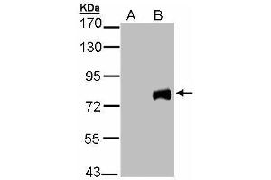 WB Image Western Blot analysis of MID2 expression in transfected 293T cell line by MID2 polyclonal antibody. (Midline 2 anticorps  (C-Term))