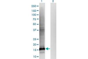 Western Blot analysis of WDHD1 expression in transfected 293T cell line by WDHD1 monoclonal antibody (M01), clone 2F10. (WDHD1 anticorps  (AA 1031-1128))
