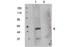 Western blot using FKBP8 polyclonal antibody  shows detection of exogenous FKBP8 in 50 ug of HEK293T whole cell lysate (Lane 1). (FKBP8 anticorps  (Internal Region))