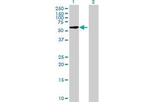 Western Blot analysis of FBXO33 expression in transfected 293T cell line by FBXO33 MaxPab polyclonal antibody. (FBXO33 anticorps  (AA 1-555))