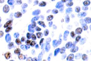 Image no. 2 for anti-Jun B Proto-Oncogene (JUNB) antibody (ABIN265489) (JunB anticorps)