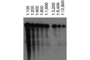Western blot analysis of ABCA1 using ABCA1 monoclonal antibody, clone 3A1. (ABCA1 anticorps)