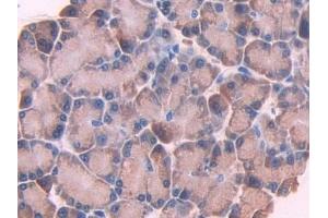 Detection of CYP1A1 in Rat Pancreas Tissue using Polyclonal Antibody to Cytochrome P450 1A1 (CYP1A1)