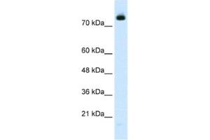 Western Blotting (WB) image for anti-Zinc Finger Protein 261 (ZMYM3) antibody (ABIN2460974) (ZMYM3 anticorps)
