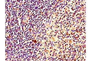 Immunohistochemistry of paraffin-embedded human spleen tissue using ABIN7169153 at dilution of 1:100