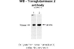 Image no. 1 for anti-Transglutaminase 2 (C Polypeptide, Protein-Glutamine-gamma-Glutamyltransferase) (TGM2) antibody (ABIN346957)