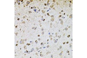 Immunohistochemistry of paraffin-embedded mouse brain using ALDH1A1 antibody. (ALDH1A1 anticorps  (AA 48-147))