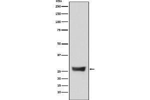 Western blot analysis of NDUFS3 expression in 293T cell lysate.