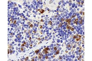 Immunohistochemistry analysis of parafffin-embedded rat spleen using Lysozyme Polyclonal Antibody at dilution of 1:400. (LYZ anticorps)