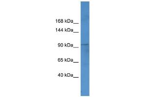 WB Suggested Anti-Ftsj3 Antibody Titration:  0. (FTSJ3 anticorps  (C-Term))